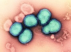 Influenza H3N2, sintomi intensi e prevenzione